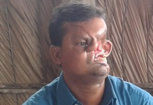 بالصورة .. رجل يكشف عن وجهه لأول مرة منذ هجوم نمر عليه من 20 عاما 2 Hashmot-Ali-2.jpg