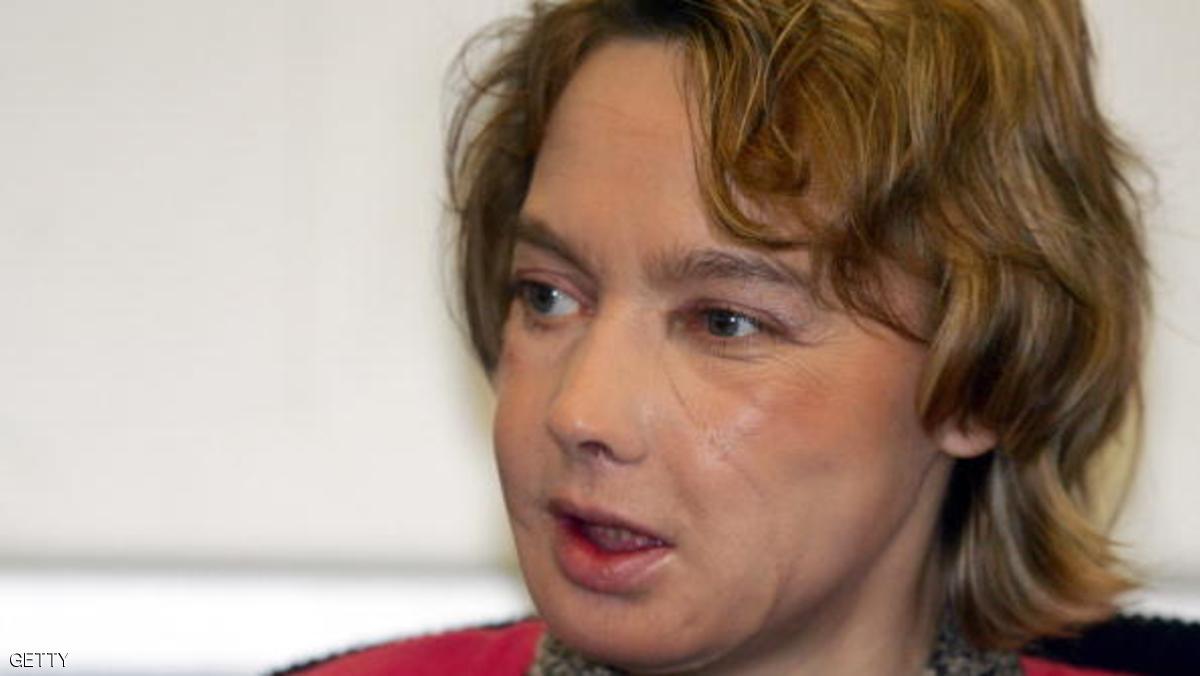 وفاة صاحبة أول وجه مزروع في العالم 1 1 872919