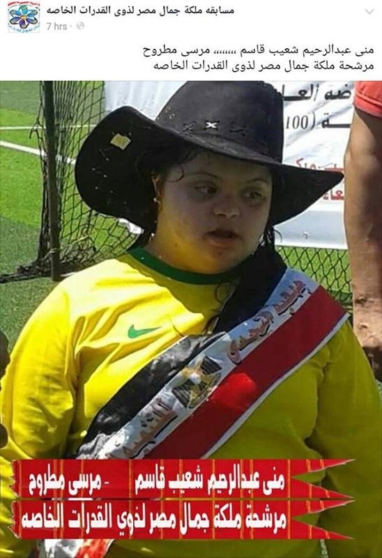 أول مسابقة مصرية لملكة جمال ذوى القدرات الخاصة2