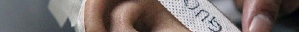 في الصين.. زراعة أذن في ذراع مريض 10 1 891670