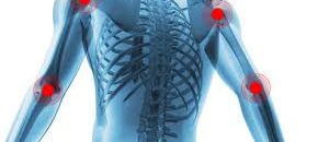 ماذا يحدث لجسمك عند تناول المايونيز؟ 10 التهاب العظام