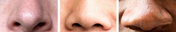 علماء: نخر الأنف يسبب المرض الأقسى لشيخوخة الإنسان 10 انف