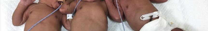 أمهات خارقات... أغرب حالات الولادة حول العالم 10 توأم