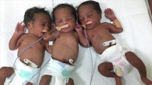 بالصورة: سودانية تنجب ثلاثة توائم وتسميهم "رجب وطيب وأردوغان" 2 توأم