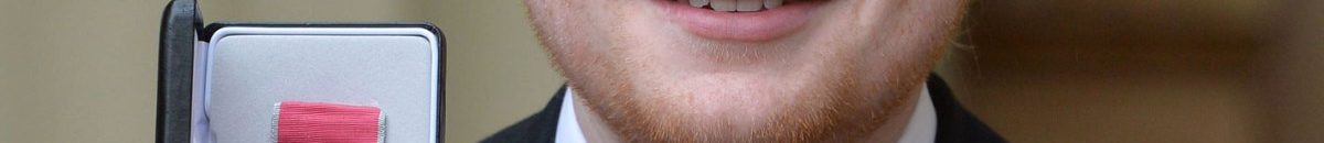 بالصورة .. “أمريكي” لديه موهبة خارقة جعلته محط أنظار الجميع في ولاية “ميتشيغان”.. هذه الصفة العجيبة ورثها ابنه ! 11 ed sheeran 3 2000 1