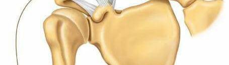 أول جهاز من نوعه لإصلاح الأعصاب التالفة في الجسم 10 طبيب سوداني يشخص إصابة اللاعب المصري محمد صلاح ويبرئ راموس من إصابته