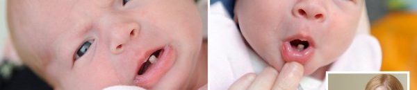 أم تتعرض لصدمة بعد ولادة طفلتها بـ(سن مكتملة) + صور 10 rXTMQpH1