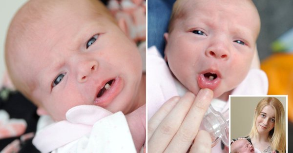 أم تتعرض لصدمة بعد ولادة طفلتها بـ(سن مكتملة) + صور 1 rXTMQpH1