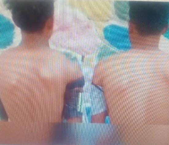 بالفيديو: آخر التقليعات الشبابية ..رقيص (لوحة الكتف) يدهش رواد مواقع التواصل 1 لوحة الكتف