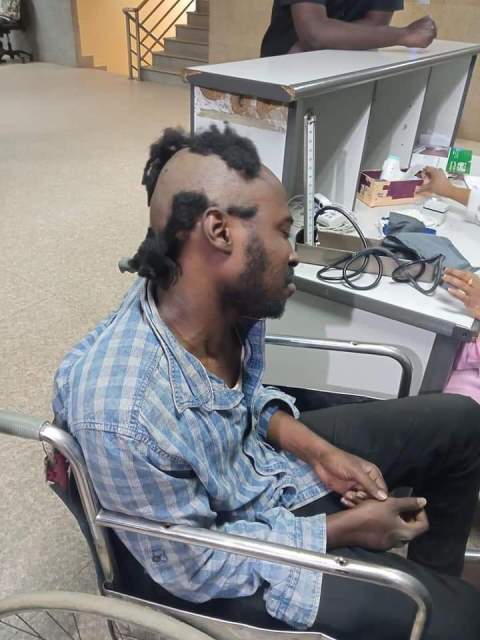 شاهد بالصورة .. الاعتداء على صحفي سوداني وحلق رأسه أنقذه مؤذن مسجد بالسوق العربي 10 متوكل عيسى