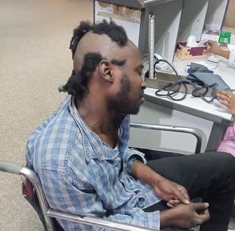 شاهد بالصورة .. الاعتداء على صحفي سوداني وحلق رأسه أنقذه مؤذن مسجد بالسوق العربي 1 متوكل عيسى