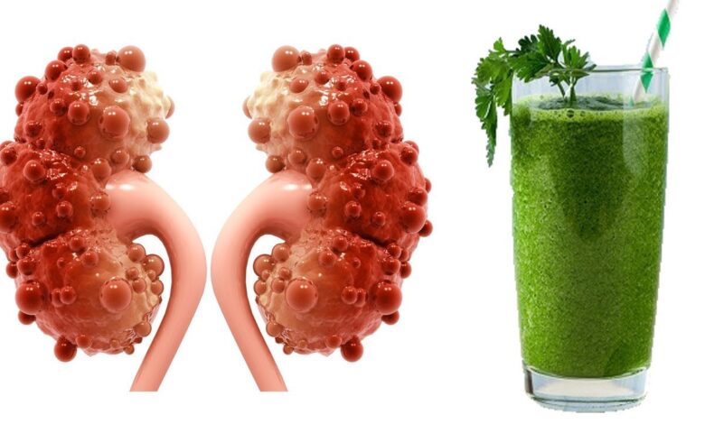 هل تعلم أن القهوة مفيدة لكليتيك أيضًا! 1 image 3 1