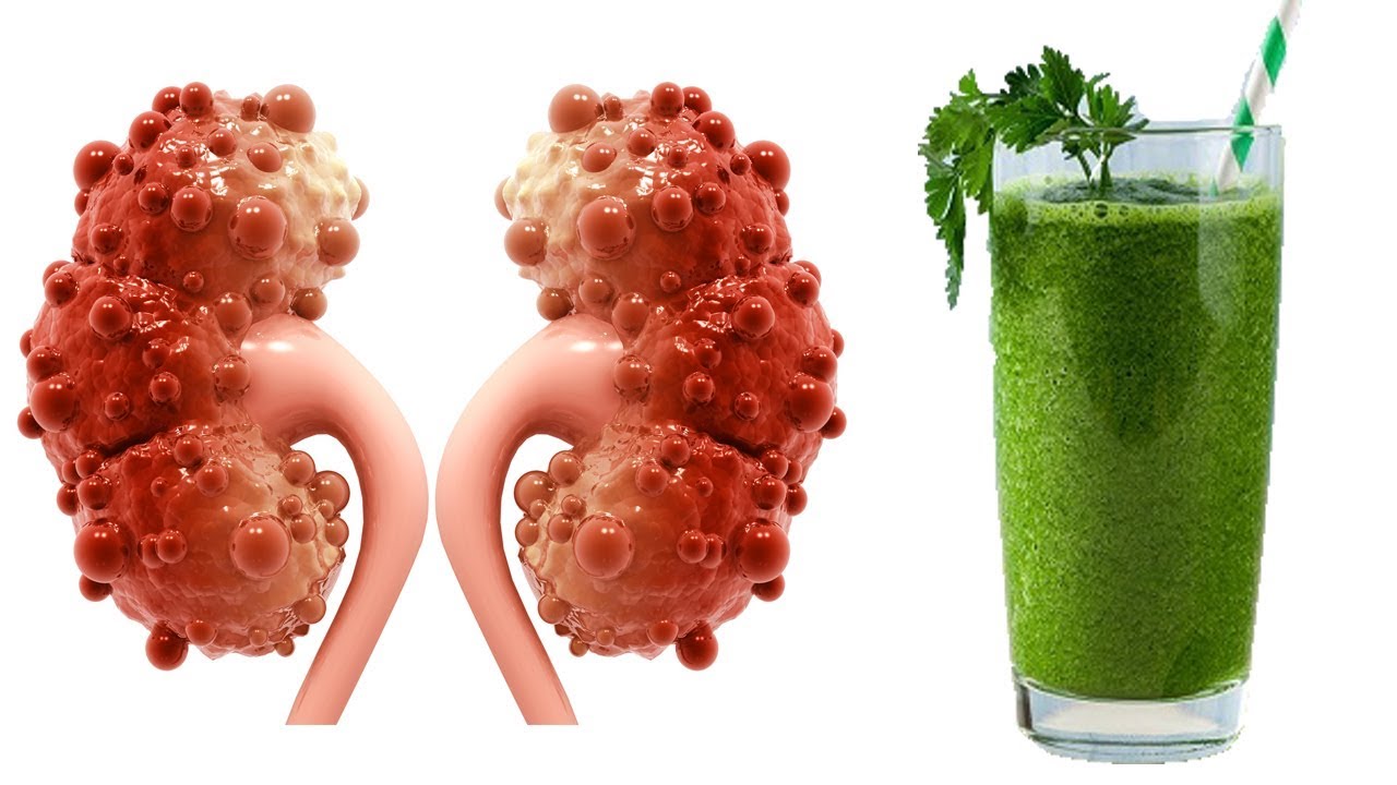 هل تعلم أن القهوة مفيدة لكليتيك أيضًا! 10 image 3 1