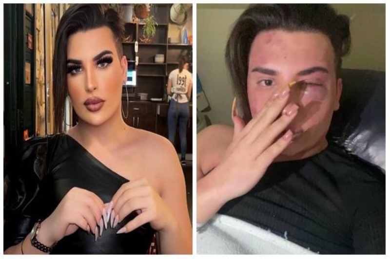 بالفيديو.. فلسطينيون يعتدون بالضرب على المتحول جنسياً "ساهر منذر" 11 تنزيل 12