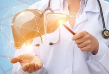 هل يمكن علاج الكبد الدهنى؟.. دراسة جديدة تربط الوقاية بفيتامين ب3 44 image 17