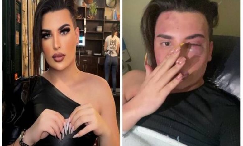 بالفيديو.. فلسطينيون يعتدون بالضرب على المتحول جنسياً "ساهر منذر" 1 تنزيل 12