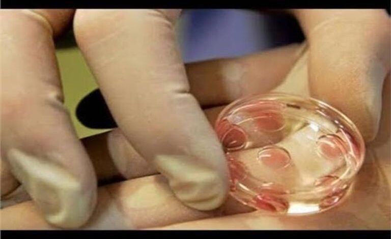عملية تجميد البويضات.. كل ما تريد معرفته عن «ترند الفنانات» 1 تجميد بويضات
