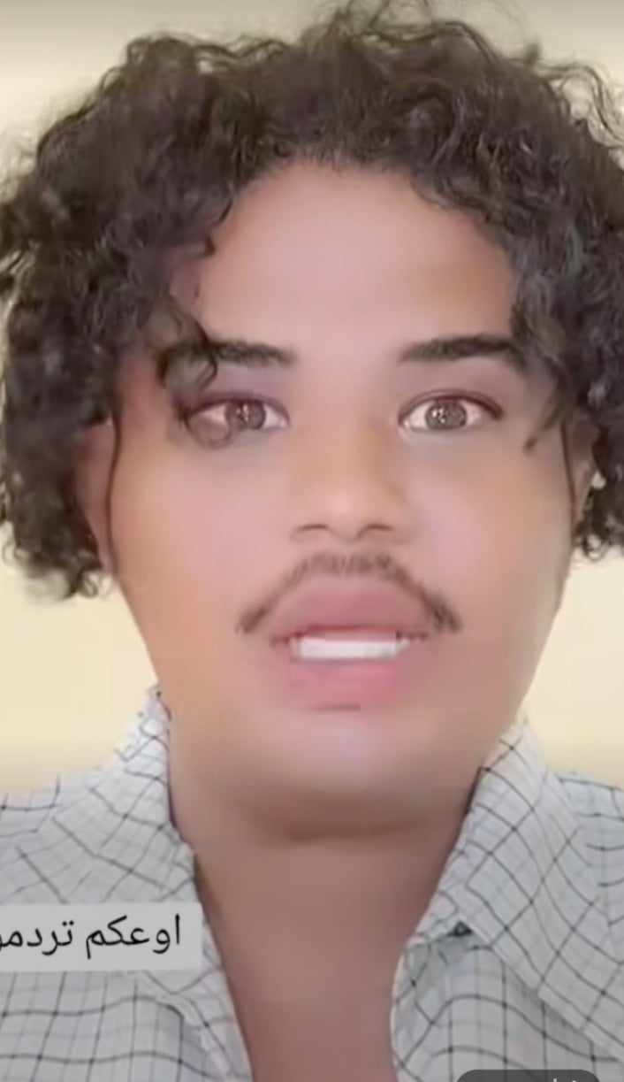 شاهد بالصورة والفيديو.. التيكتوكر السوداني المثير للجدل "ميشو": (أتمتع بأنوثة أكثر من حنان حسن وسأقود متحرك للدعامة مع صلاح سندالة فاقد الرجالة وحمدوك أب كريشة الغليت العيشة) 10 ميشو