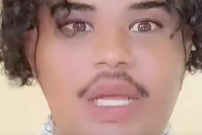 شاهد بالصورة والفيديو.. التيكتوكر السوداني المثير للجدل "ميشو": (أتمتع بأنوثة أكثر من حنان حسن وسأقود متحرك للدعامة مع صلاح سندالة فاقد الرجالة وحمدوك أب كريشة الغليت العيشة) 1 ميشو