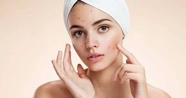 82016116247111حب الشباب