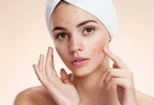 82016116247111حب الشباب