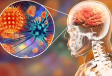 "نيباه" يثير القلق: أعراض خطيرة واحتمالية انتقال للبشر 23 9515063