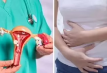 آلام الدورة ليست دائمًا طبيعية.. إشارات تكشف بطانة الرحم المهاجرة مبكرًا 41 202107270220482048