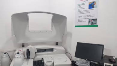 التأمين الصحي بالنيل الأبيض يوفر جهاز حديث لتحليل الكيمياء السريرية بالمعمل التش 2 672451272 991167786598260 8955221485617306546 n 1140x855 1