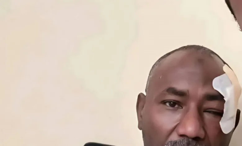صور وفيديو.. أنقذته العناية الإلهية من موت محقق بعد احتراق سيارته.. العميد طارق الهادي يحكي تفاصيل الحادث المروع 3 709428822 2058594788376112 5320966120206234736 n