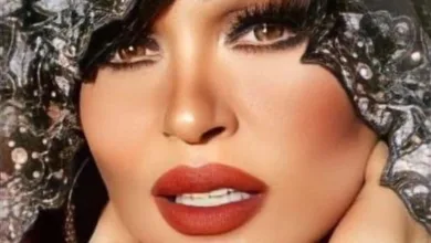 بعد كسر قدمها.. فيفي عبده تكشف احتمالية خضوعها لعملية 2 9e3a7946 b16e 41b9 a949 6fda80bba3fd 16x9 1200x676