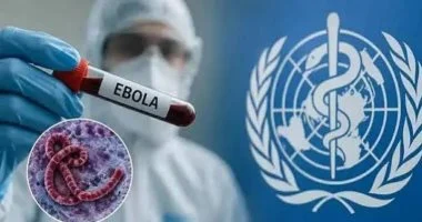 الصحة العالمية : 3605 حالات مؤكدة لإيبولا من سلالة بونديبوجيو منها 1587 وفاة 1 20260722040134134 169