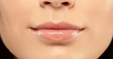 202608121212351235 581