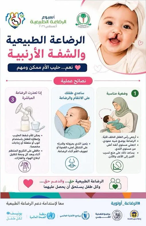 الرضاعة الطبيعية والشفة الأرنبية 10 FB IMG 1787394229025