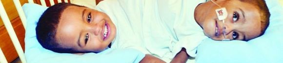 نجاح فصل توأم سيامي سوداني بشكل كامل بالسعودية 10 4512